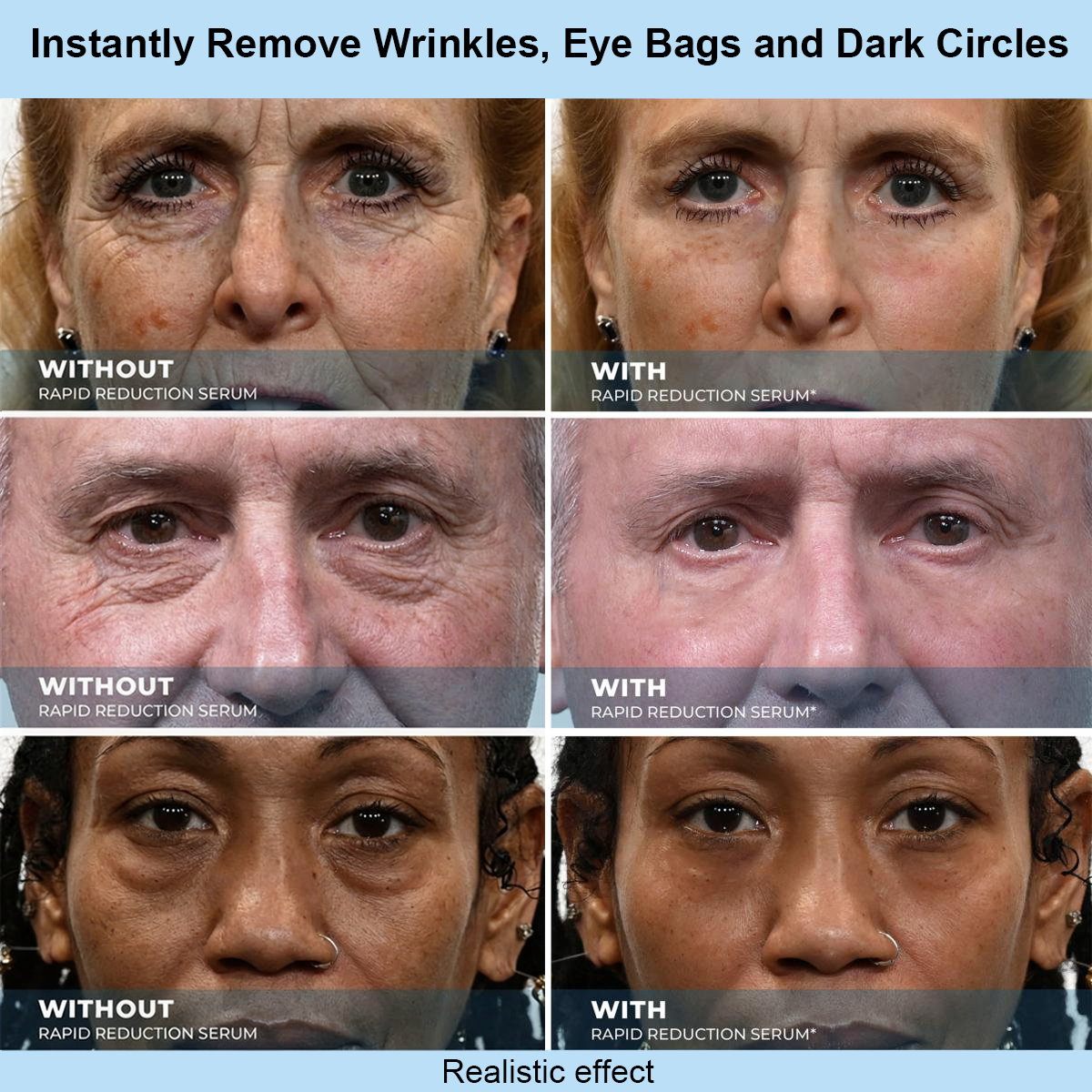 LOVIVONE™ Instant Face Temporary Tightener – Instant visible results in 60 seconds