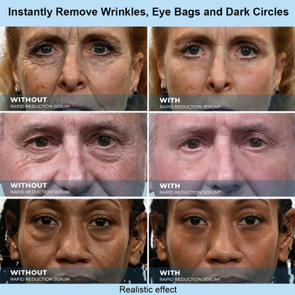 LOVIVONE™ Instant Face Temporary Tightener – Instant visible results in 60 seconds